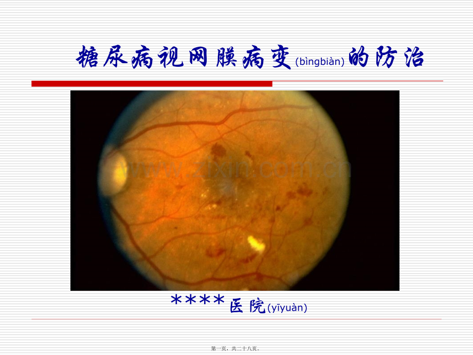 糖尿病视网膜病变宣教[1].ppt_第1页