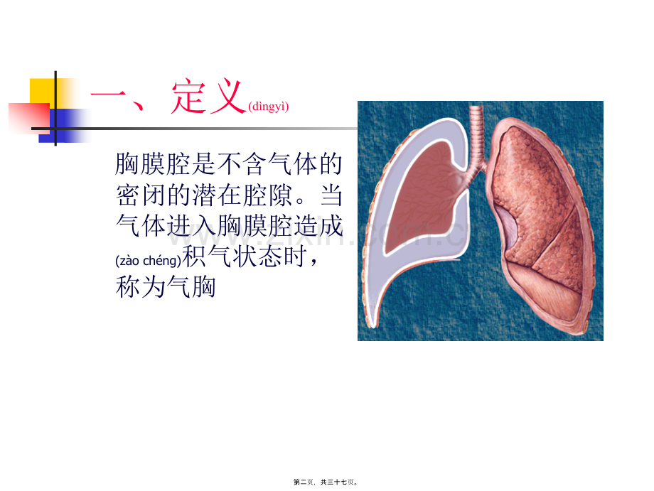 第十一章-第三节-气胸.ppt_第2页