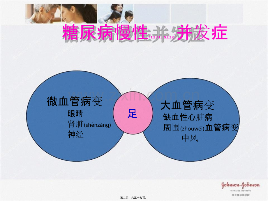 糖尿病慢性并发症---微血管病变.pptx_第2页