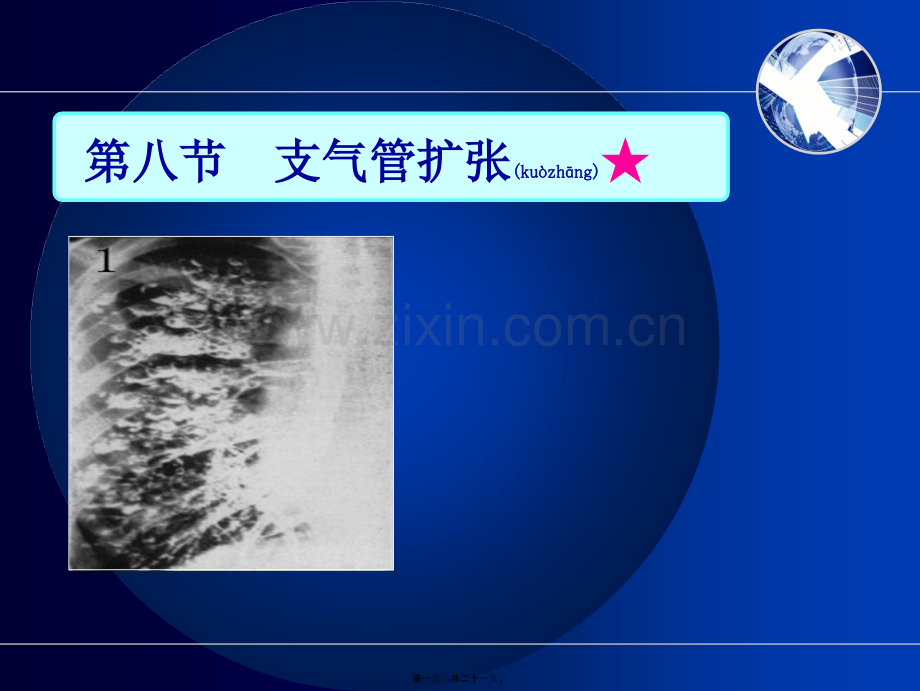 第八节支气管扩张.ppt_第1页