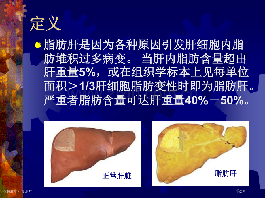 脂肪肝的营养治疗.pptx_第2页