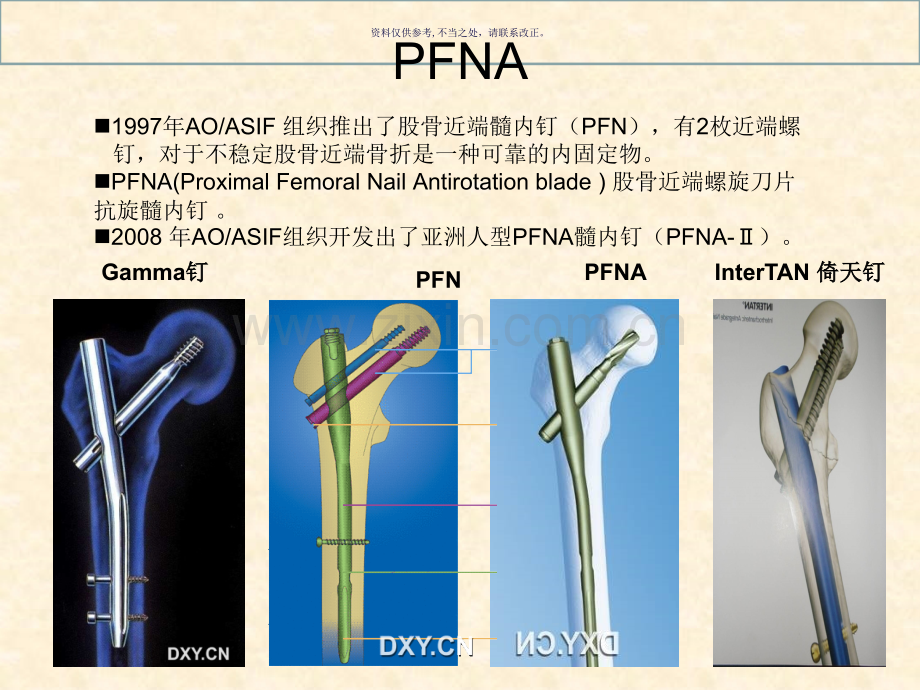 PFNA技术详解.ppt_第1页