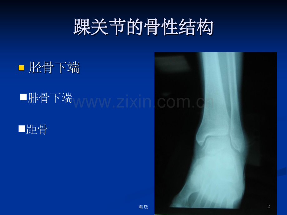 踝关节骨折的诊断及治疗ppt课件.ppt_第2页