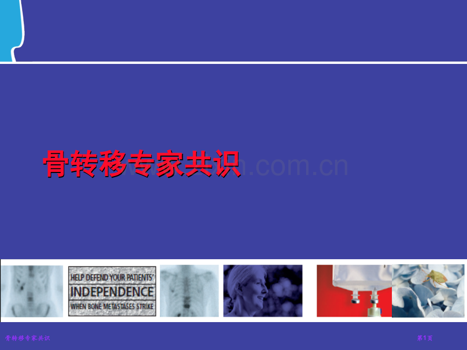 骨转移专家共识.pptx_第1页
