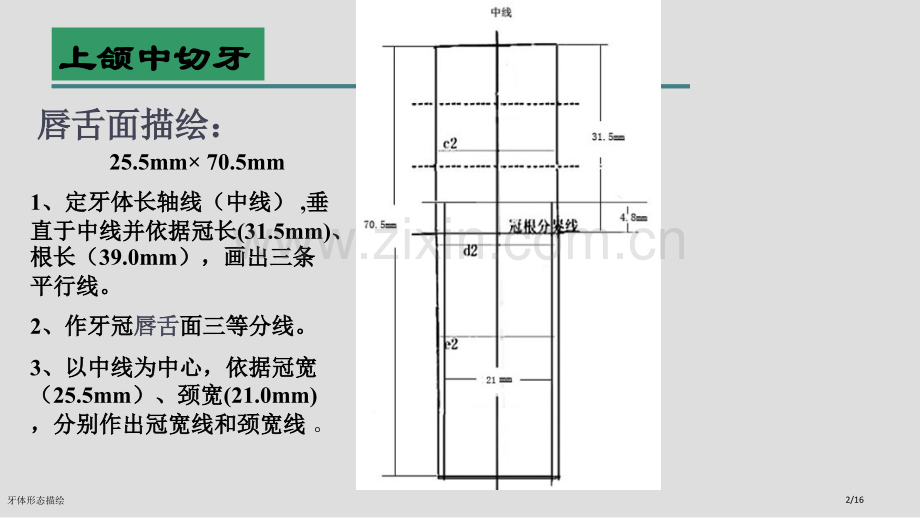牙体形态描绘.pptx_第2页