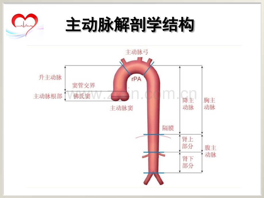 主动脉夹层的诊断与治疗.ppt_第2页