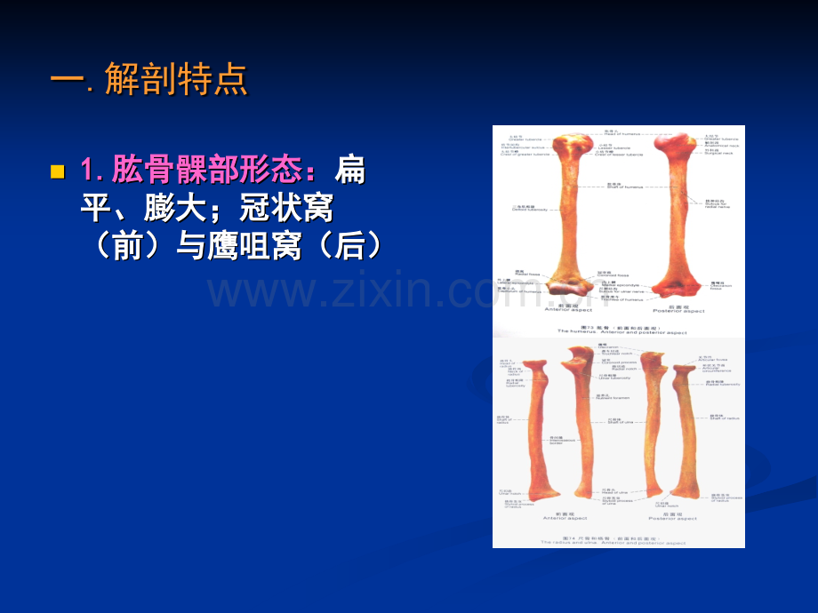 小儿肱骨髁上骨折PPT优质课件.ppt_第2页