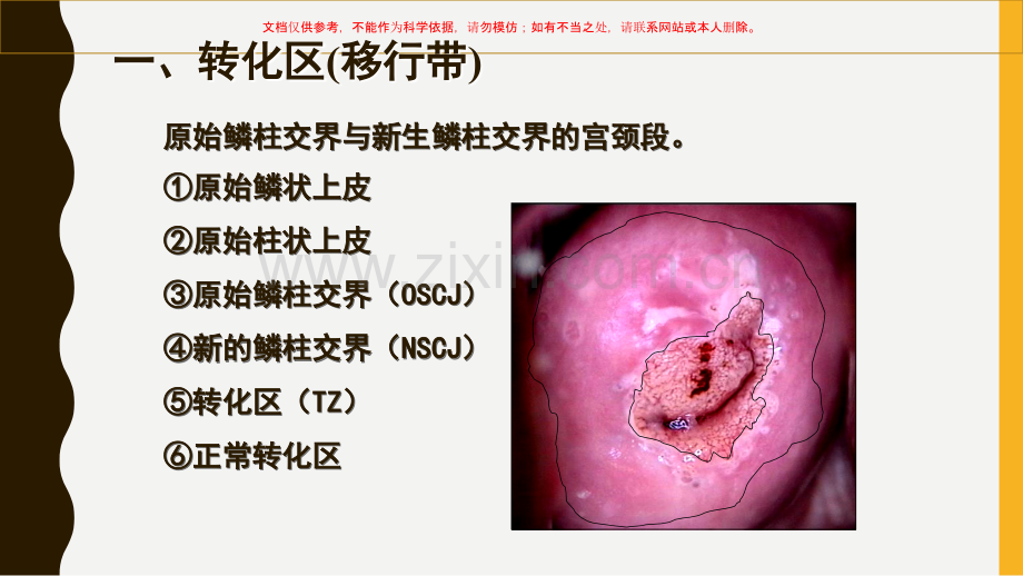宫颈癌筛查文献汇报HPV和TCT课件.ppt_第1页
