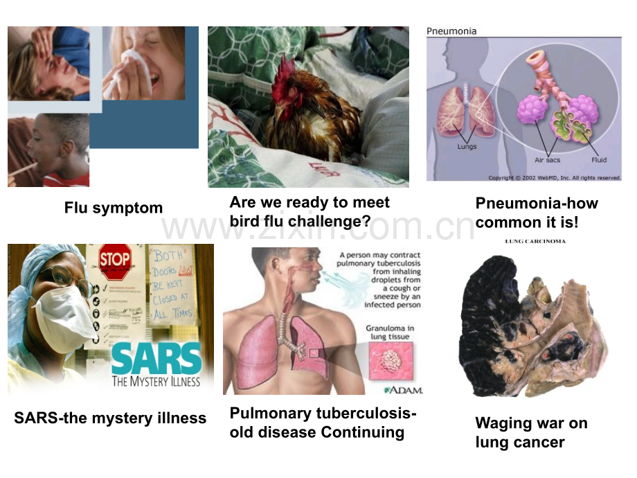 医学病理学肺炎课件.ppt_第2页