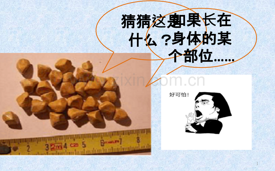 胆结石健康教育-ppt课件.pptx_第1页