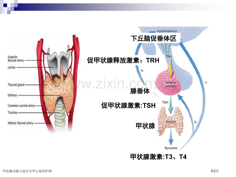 甲状腺功能亢进合并甲心病的护理.pptx_第2页