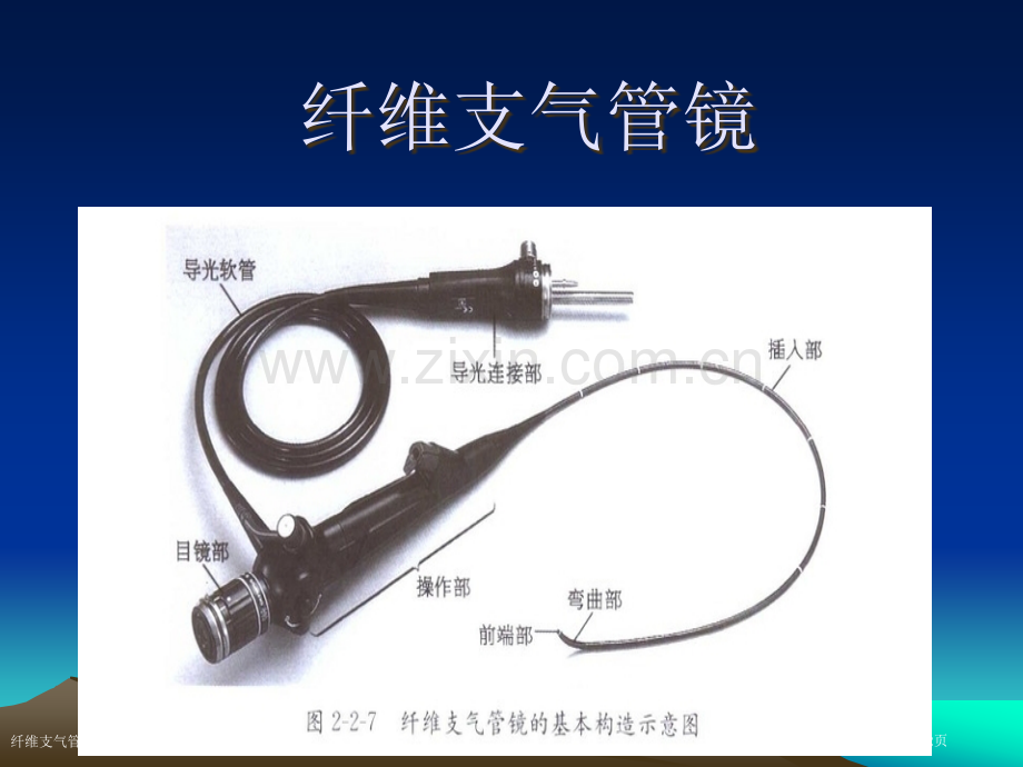 纤维支气管镜.pptx_第2页