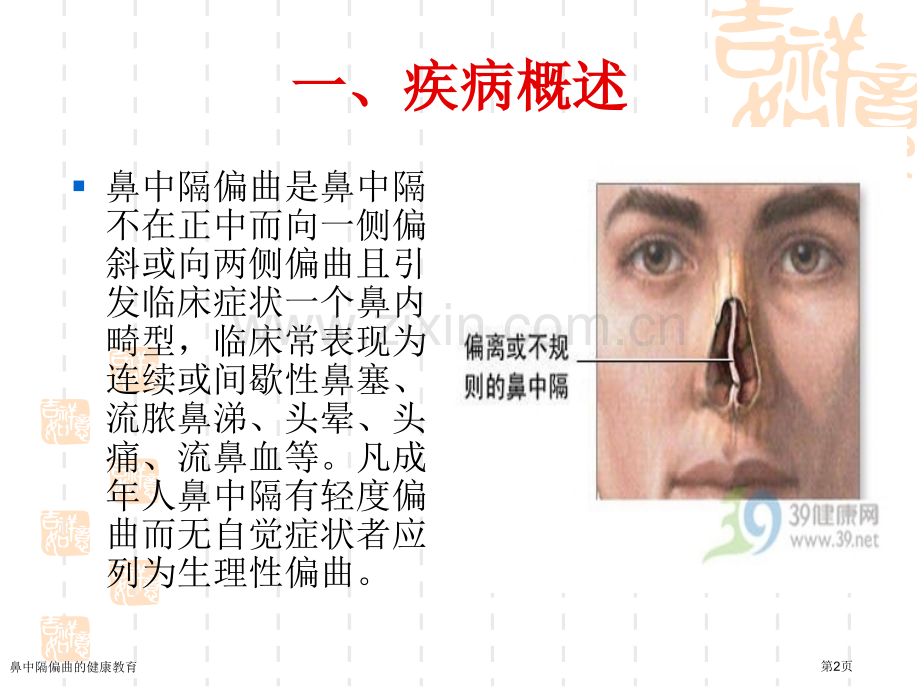 鼻中隔偏曲的健康教育.pptx_第2页