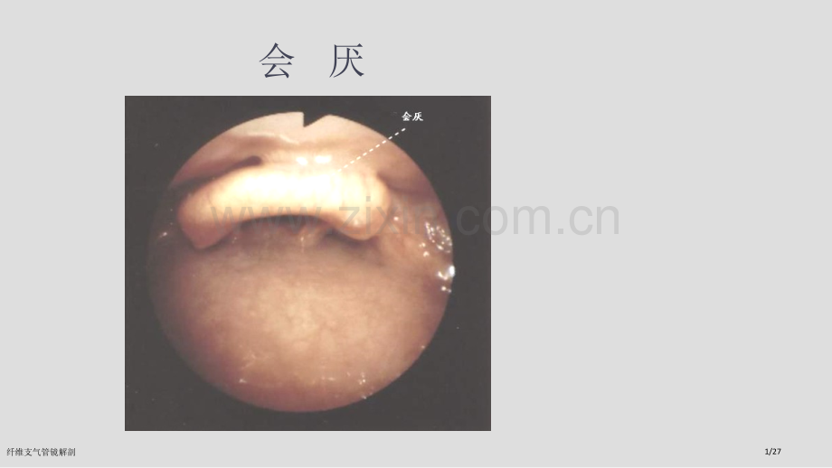 纤维支气管镜解剖.pptx_第1页