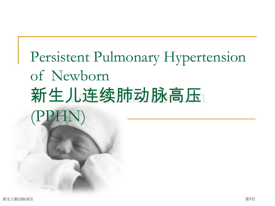 新生儿肺动脉高压.pptx_第1页