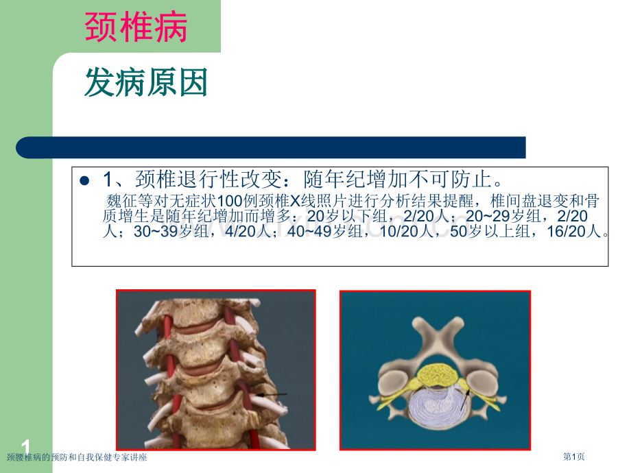 颈腰椎病的预防和自我保健专家讲座.pptx_第1页