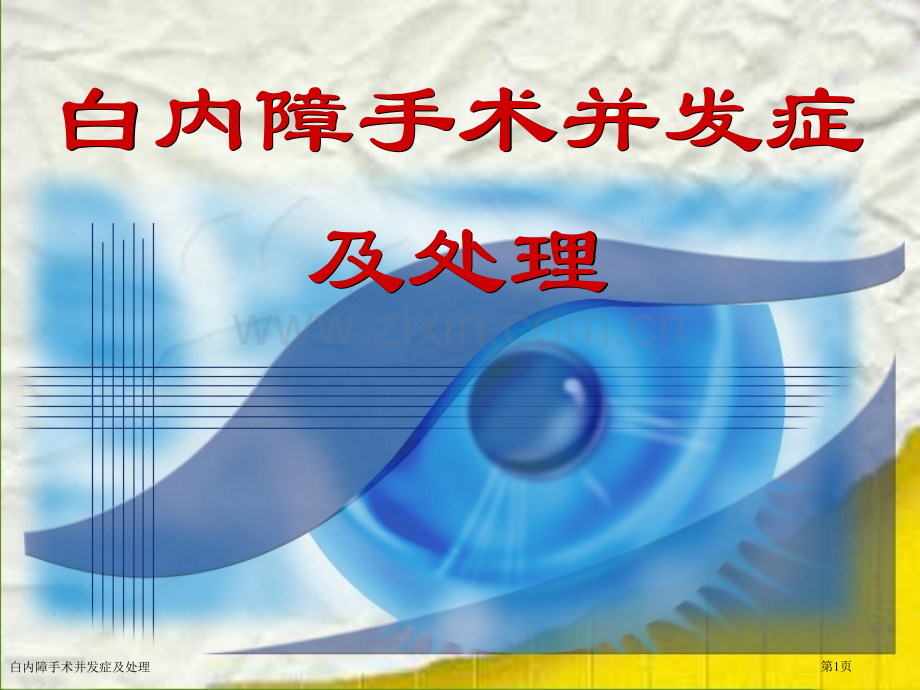 白内障手术并发症及处理.pptx_第1页