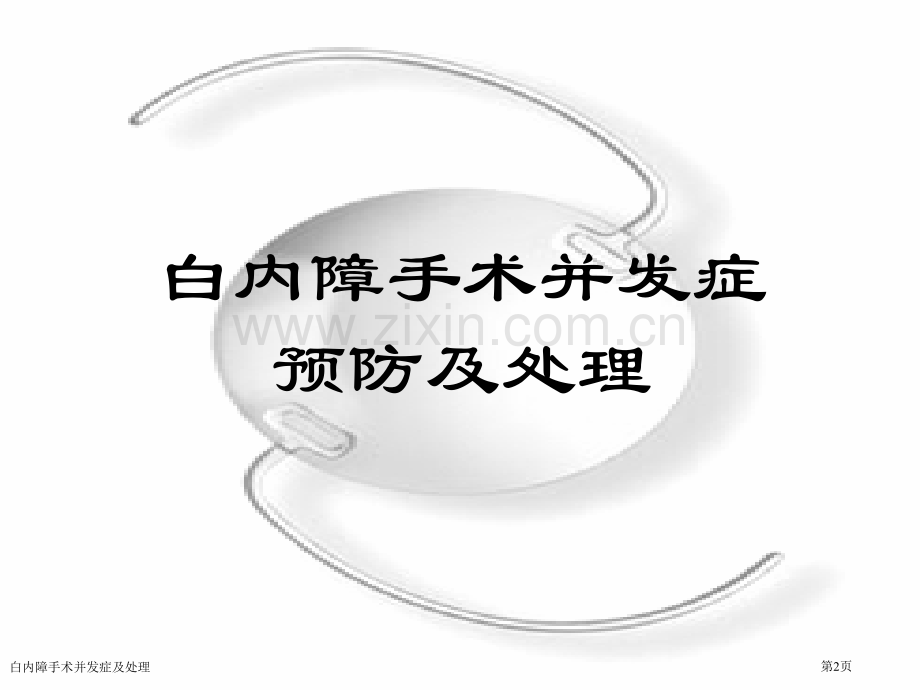 白内障手术并发症及处理.pptx_第2页
