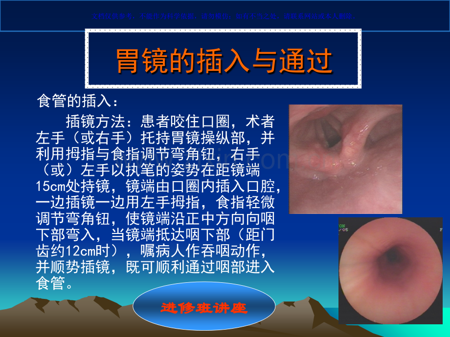 胃镜操作技巧与观察课件.ppt_第2页