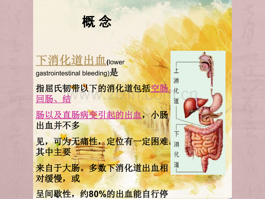 下消化道出血护理查房.ppt_第2页