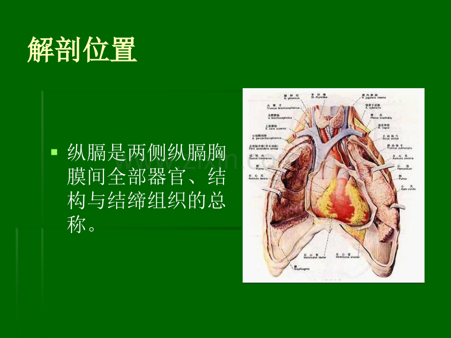 纤维素性纵隔炎ppt课件.ppt_第2页