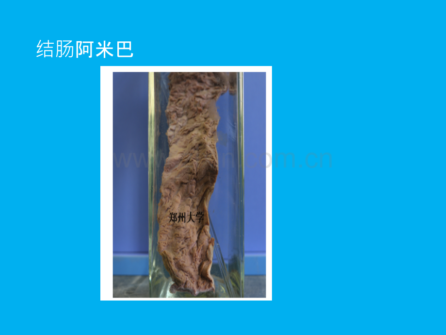 郑州大学临床医学病理学课堂大体ppt课件.ppt_第1页