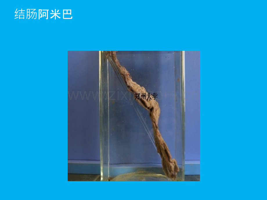 郑州大学临床医学病理学课堂大体ppt课件.ppt_第2页