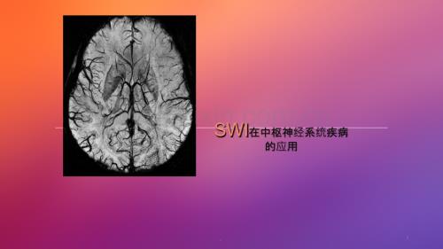 SWI在中枢神经系统应用ppt课件.ppt