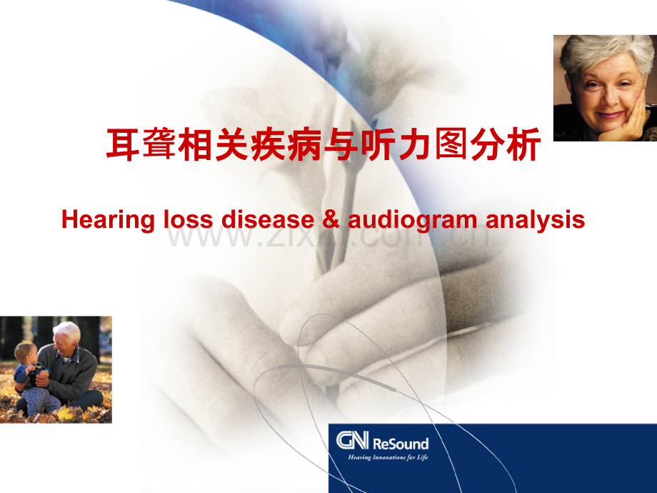 耳聋相关疾病与听力图分析讲诉PPT课件.ppt_第1页