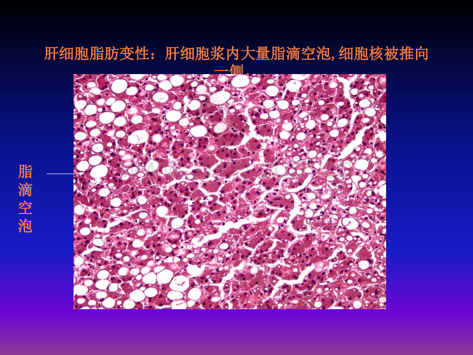病理学图片库ppt课件.ppt_第2页