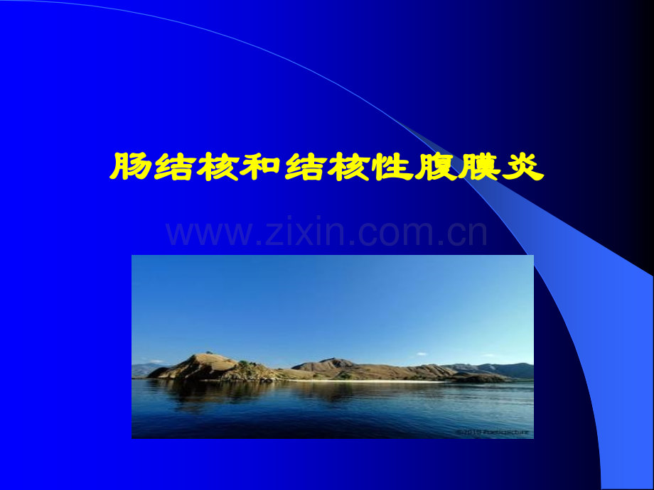 肠结核及结核性腹膜炎病人的护理ppt课件.ppt_第1页