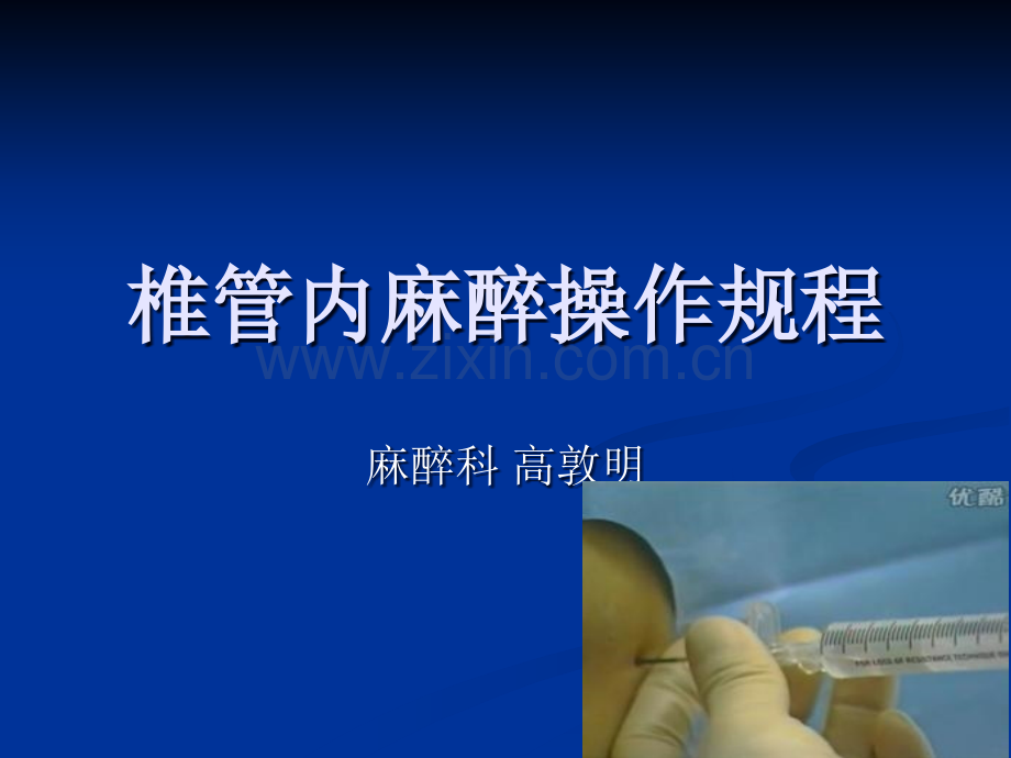 椎管内麻醉操作规程.ppt_第1页