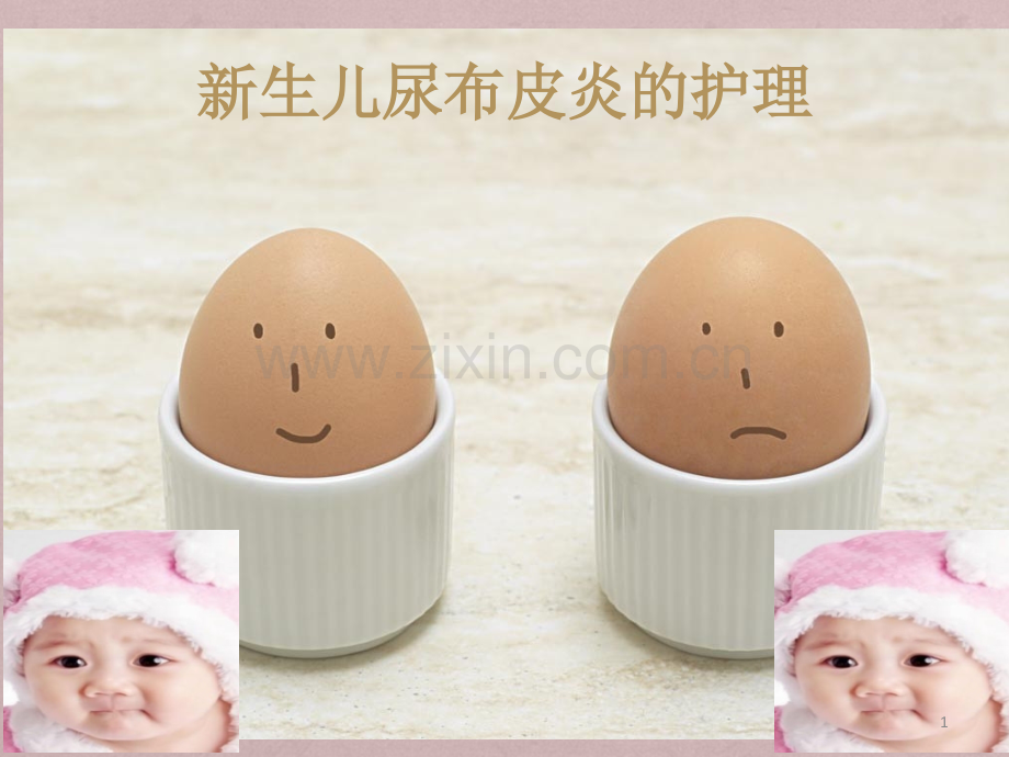 新生儿尿布皮炎的护理PPT课件.ppt_第1页
