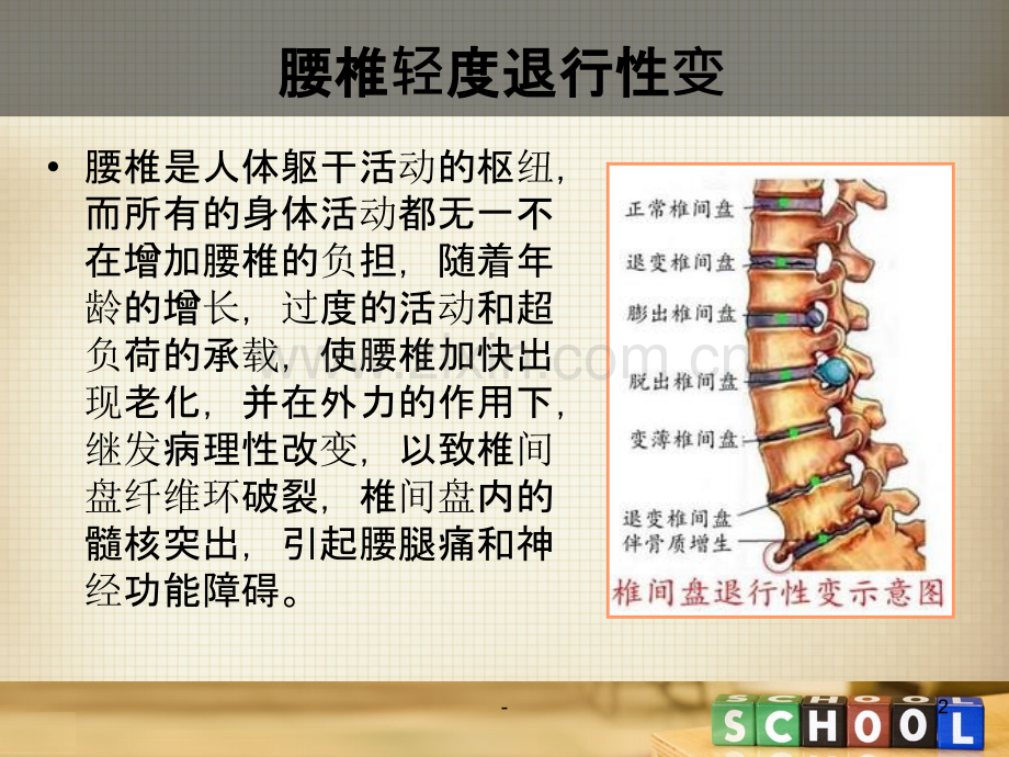 腰椎轻度退行性变PPT课件.ppt_第2页