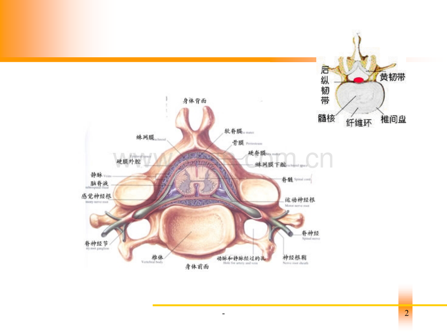 腰椎间盘突出症病人的护理PPT课件.ppt_第2页