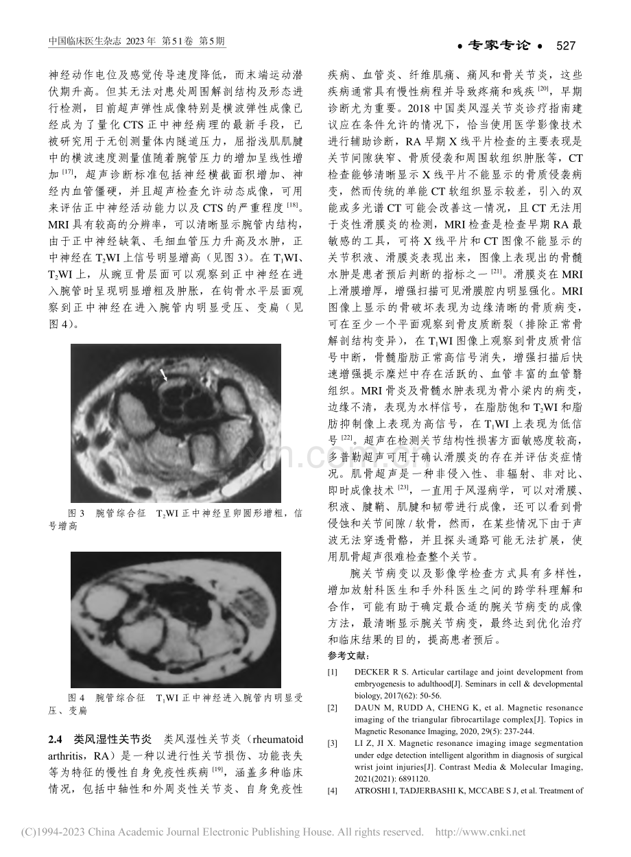腕关节病变影像学诊断_王嵩.pdf_第3页