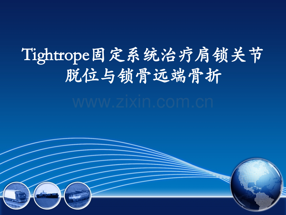 固定系统治疗肩锁关节脱位与锁骨远端骨折PPT医学课件.ppt_第1页