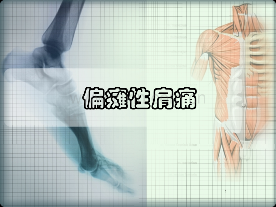偏瘫性肩痛.ppt_第1页