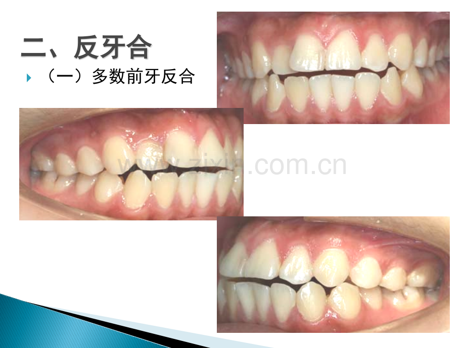 口腔设备学.pptx_第2页