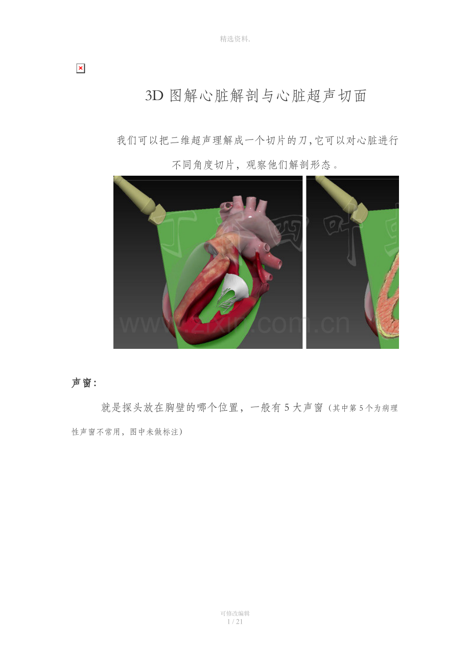 图解心脏解剖与心脏超声切面.doc_第1页