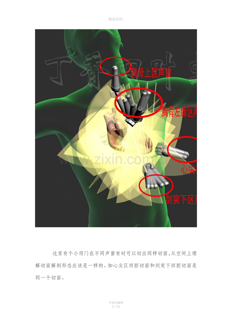图解心脏解剖与心脏超声切面.doc_第2页