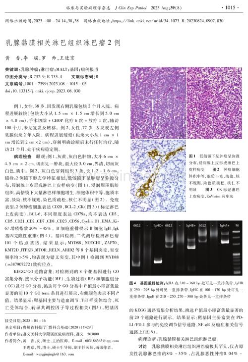 乳腺黏膜相关淋巴组织淋巴瘤2例.pdf