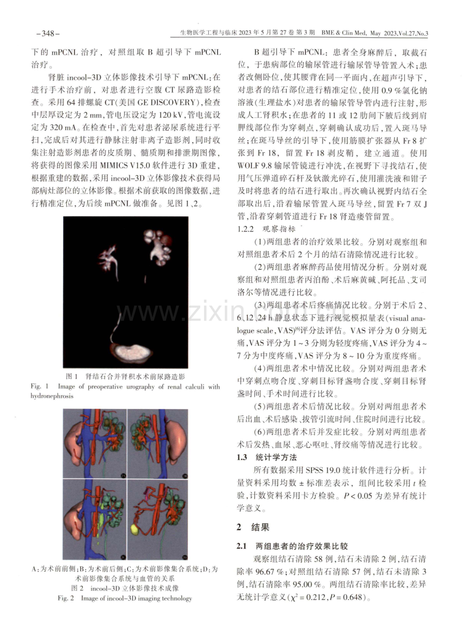肾脏incool-3D立体影像技术在经皮肾镜碎石取石术中的应用及对结石清除率和术后恢复的影响.pdf_第3页