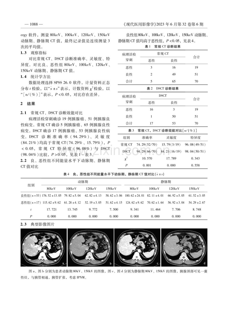 双源CT双能量扫描诊断胰腺肿瘤的价值探讨.pdf_第2页