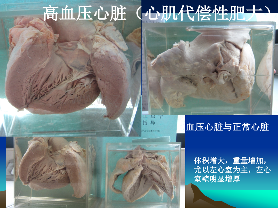 病理学大体标本03342.ppt_第1页