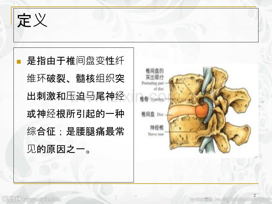 腰椎间盘突出症的护理详解PPT课件.ppt_第2页
