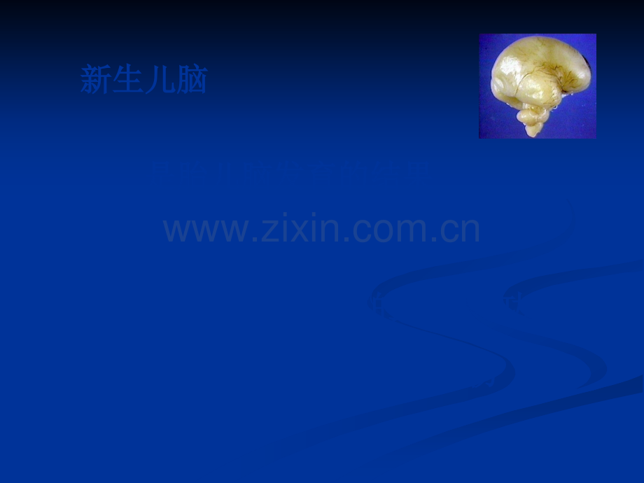 aEEG对新生儿脑功能监测意义.ppt_第2页