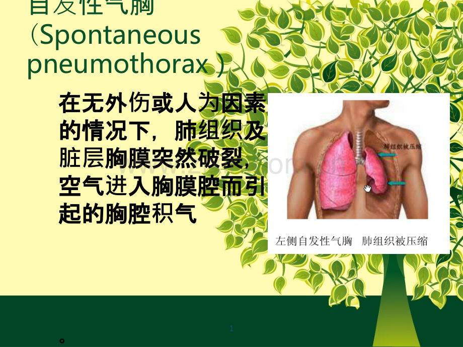 张力性气胸-PPT课件.ppt_第1页