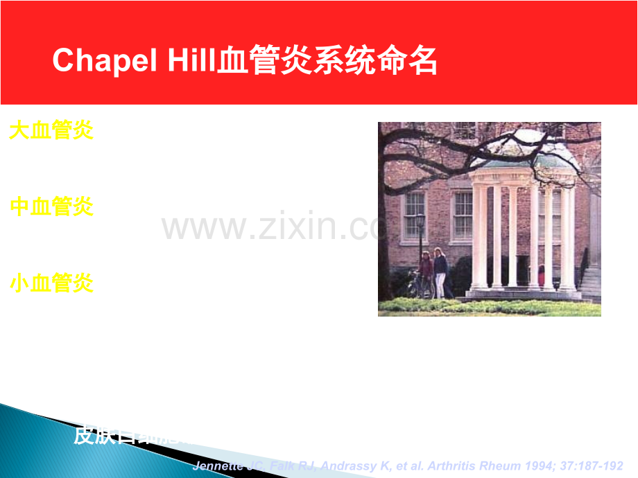 ANCA相关性小血管炎ppt课件.ppt_第2页