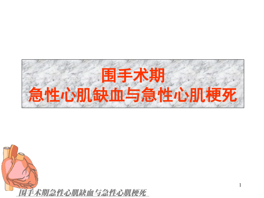 围手术期急性心肌缺血和心肌梗死PPT课件.ppt_第1页